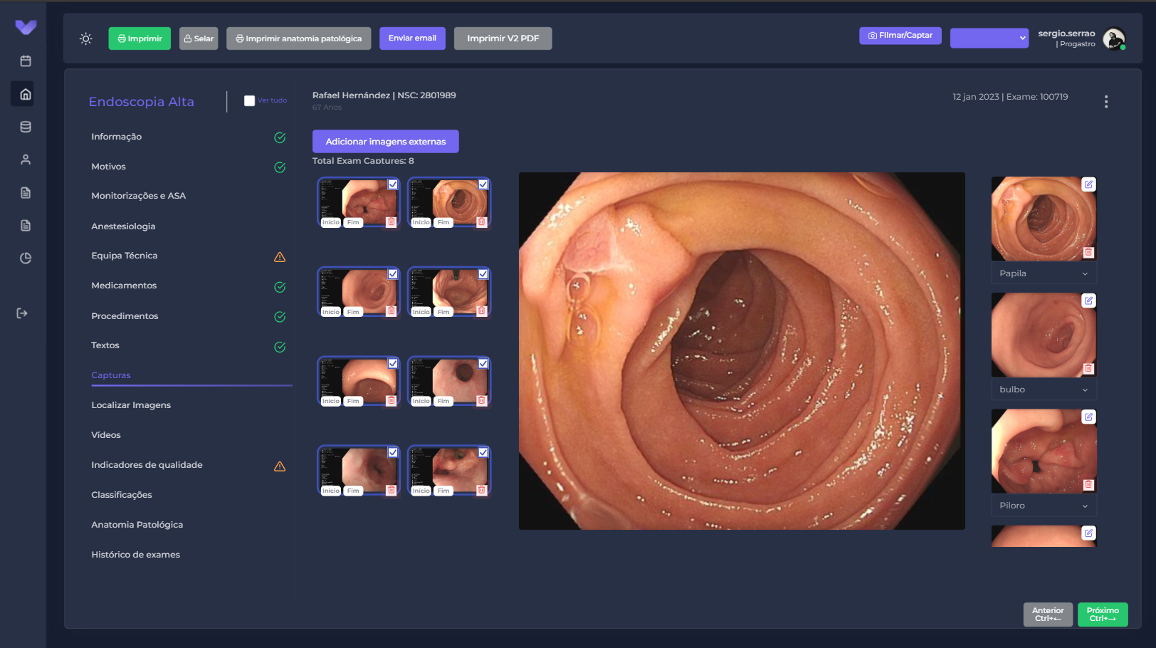 VisionAI endoscopia modo escuro